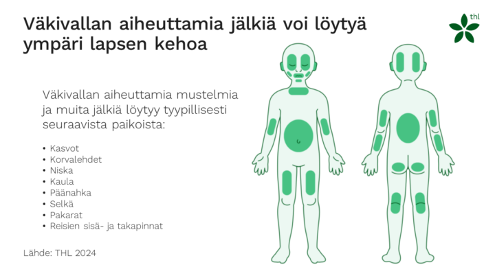 Väkivallan aiheuttamia jälkiä voi löytyä ympäri lapsen kehoa. Väkivallan aiheuttamia mustelmia ja muita jälkiä löytyy tyypillisesti seuraavista paikoista: kasvot, korvalehdet, niska, kaula, päänahka, selkä, pakarat ja reisien sisä- ja takapinnat.